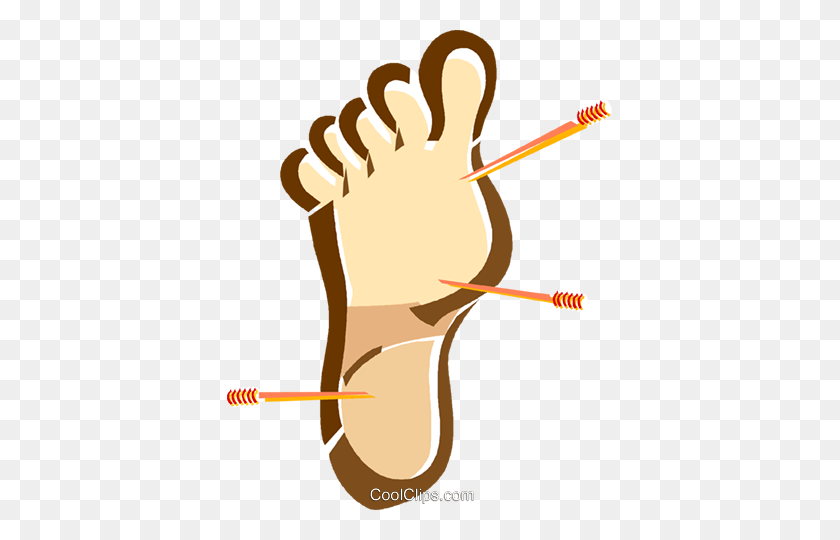 385x480 Acupuncture, Pressure Points Royalty Free Vector Clip Art - Acupuncture Clipart