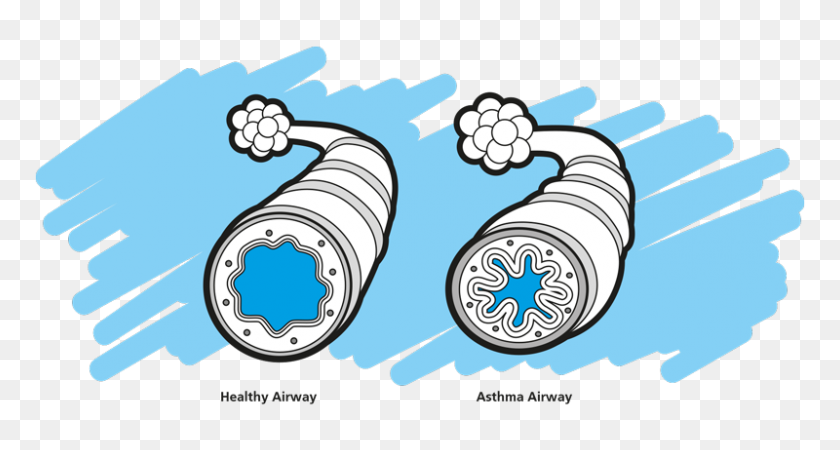 800x400 Asthma Clip Art - Inhaler Clipart