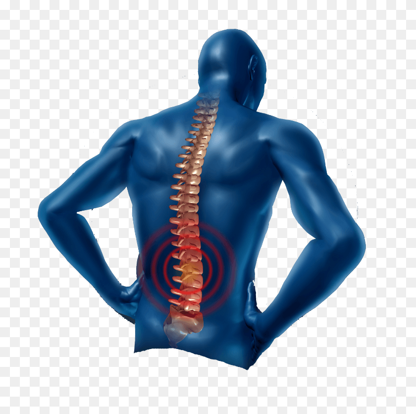 775x775 Back Pain Png Human Dummy Florida Pain Management, Pain - Pain PNG