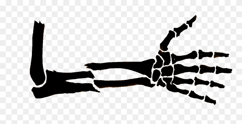 1100x527 Сломанная Рука - Черно-Белый Рентгеновский Клипарт