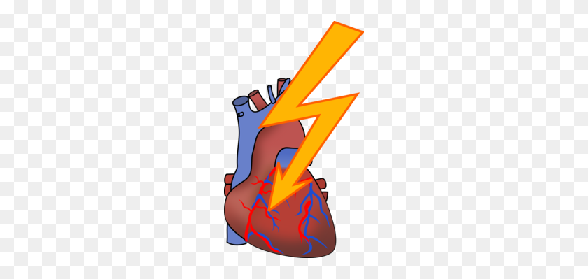 200x339 Cardiovascular Disease Cardiology Heart Medicine - Medical Heart Clipart