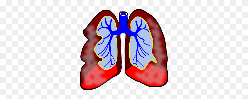 300x275 Clipart Lung Cancer - Cancer Clipart