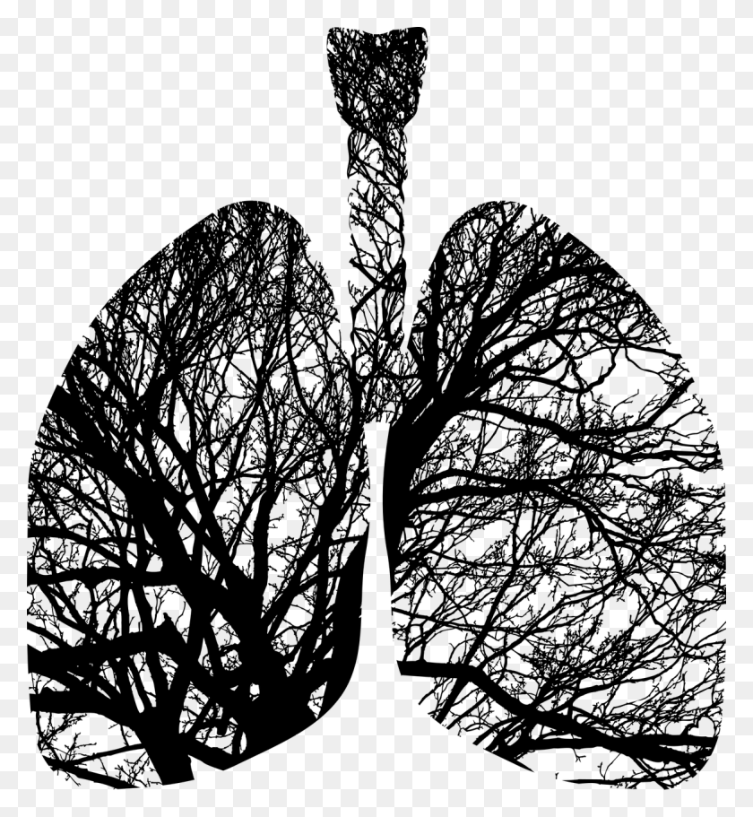 1173x1280 Cystic Fibrosis Archives - Cystic Fibrosis Clipart