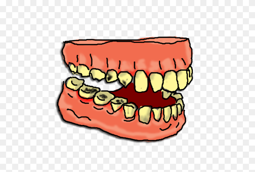 561x507 Decay Clipart Rotten Tooth - Gross Food Clipart