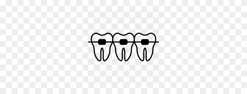 260x260 Download Teeth With Braces Clipart Dental Braces Clip Art - Free Dental Clipart