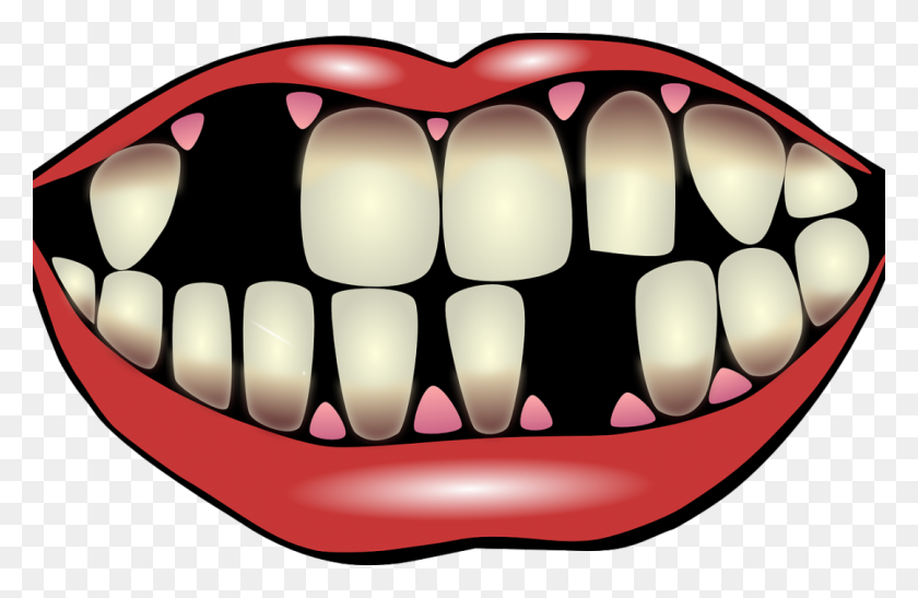 1080x675 Factors For Losing Your Teeth Port Pediatric Dentistry - Losing Clipart