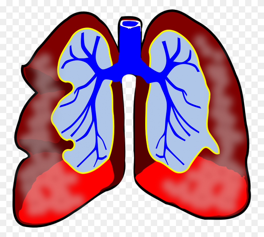 807x720 Global Asthma Copd Market To See Major Growth - Skin Cancer Clipart