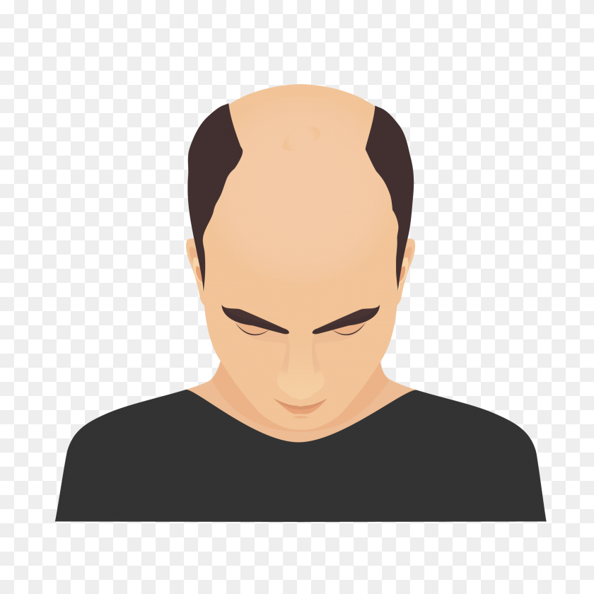 2084x2084 Hair Loss Treatment For Men Hair Transplant Hair - Mens Hair PNG