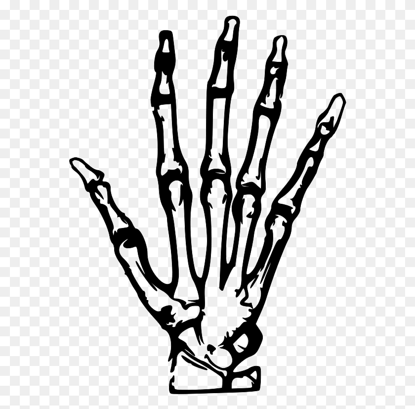 562x767 Рука Рентгеновский Векторный Файл, Векторная Графика - Скелет Черно-Белый Клипарт