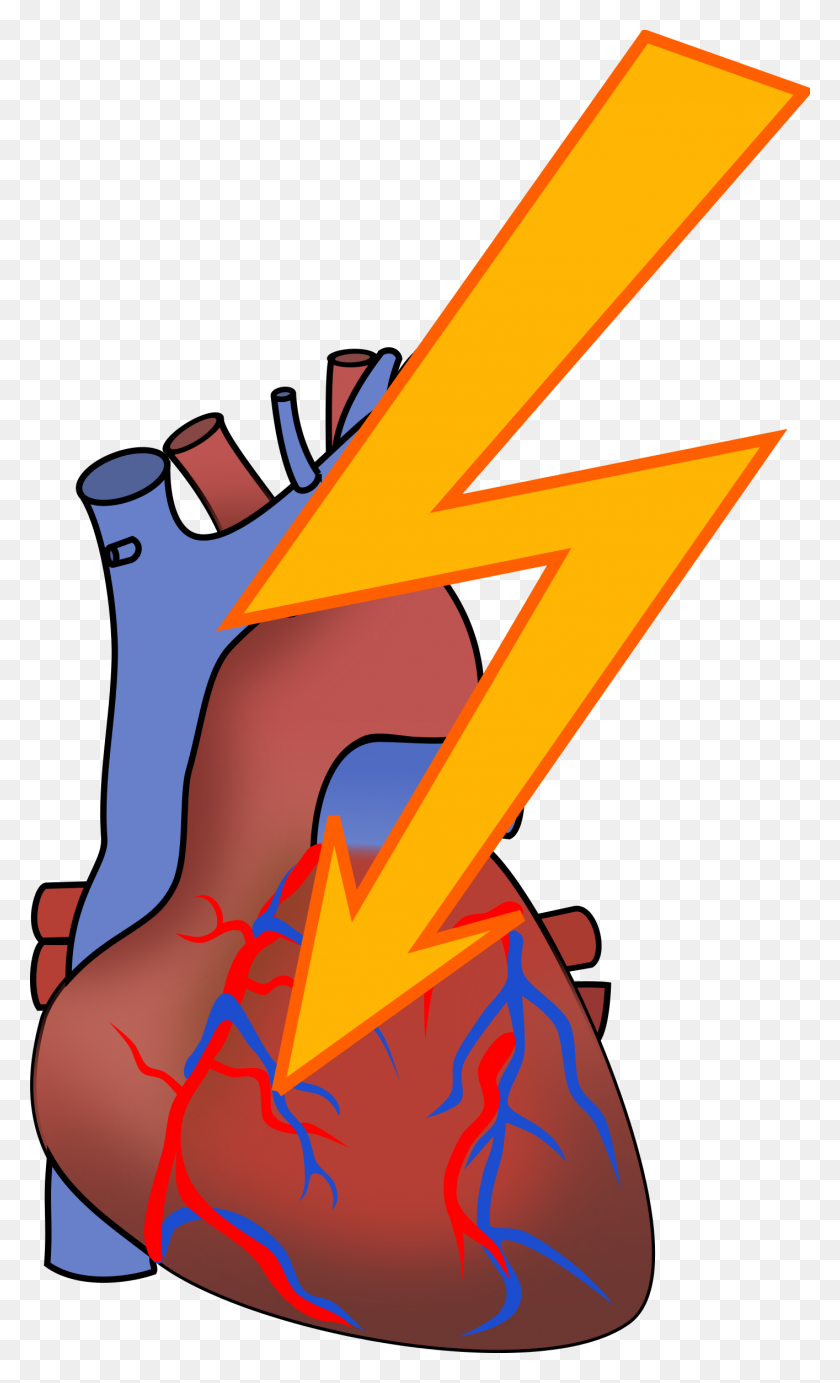 1414x2400 Heart Attack Clip Art - Get Dressed Clipart