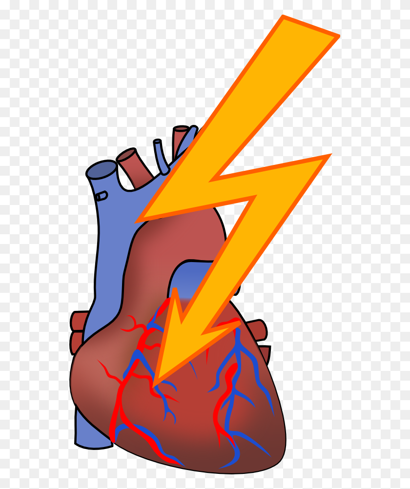 555x942 Heart Attack Clipart Look At Heart Attack Clip Art Images - Risk Clipart