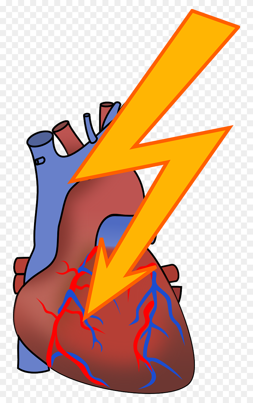 754x1280 Heart Failure Is Getting Younger In Singapore And That's Not - Good Choices Clipart