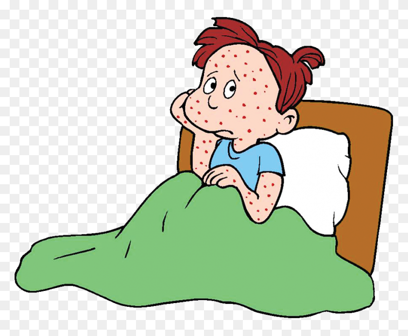 904x734 How To Deal With Chickenpox - Itch Clipart
