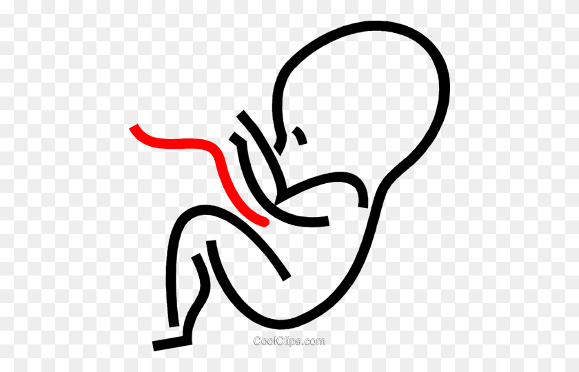 466x480 Human Fetus Royalty Free Vector Clip Art Illustration - Fetus Clipart