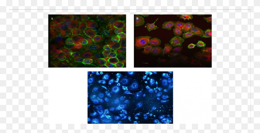 850x405 Imágenes In Vitro De Microscopía De Fluorescencia Confocal Ns - Textura De Agua Png