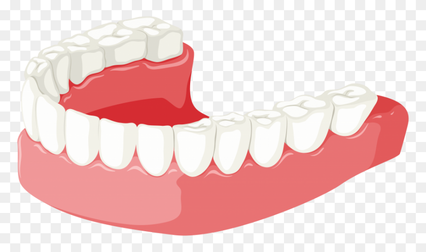 850x477 Lower Jaw Png - Dentures Clipart