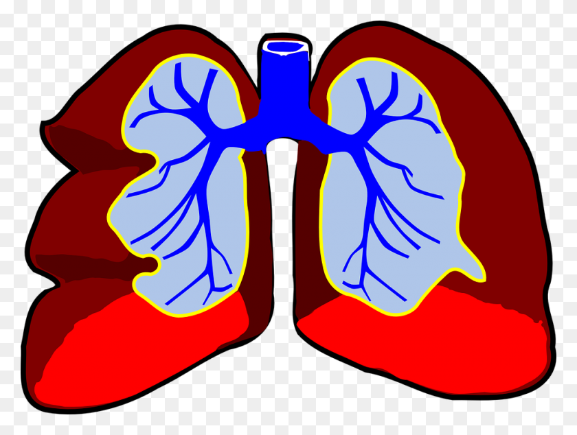 960x707 Lungs Infection Prevent Ers Health Inc - Infection Clipart