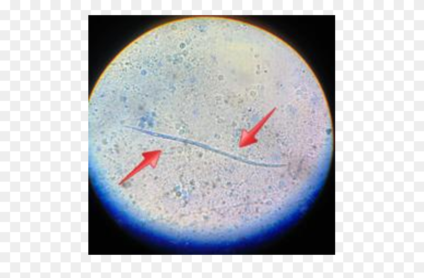 722x491 Microfilarias En La Prueba De Knott Modificada Frotis De Higo Adulto - Frotis De Sangre Png
