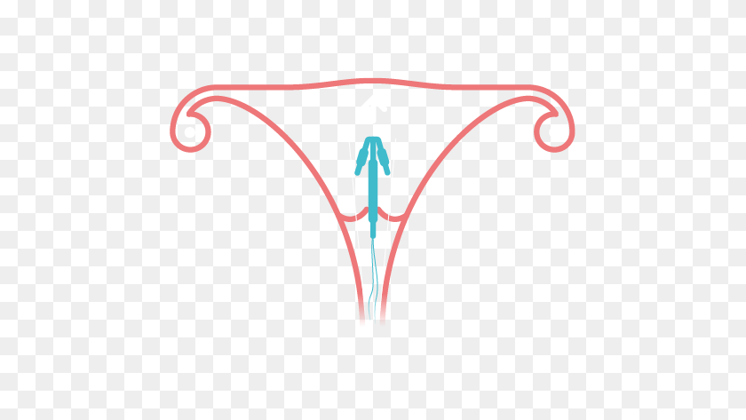 619x413 Información Sobre La Bobina No Hormonal: Imágenes Prediseñadas De La Prueba De Embarazo