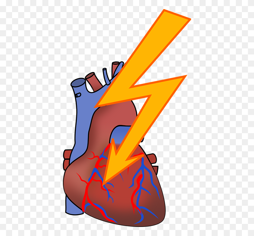 424x720 Rate Clipart Heart Failure - Failure Clipart