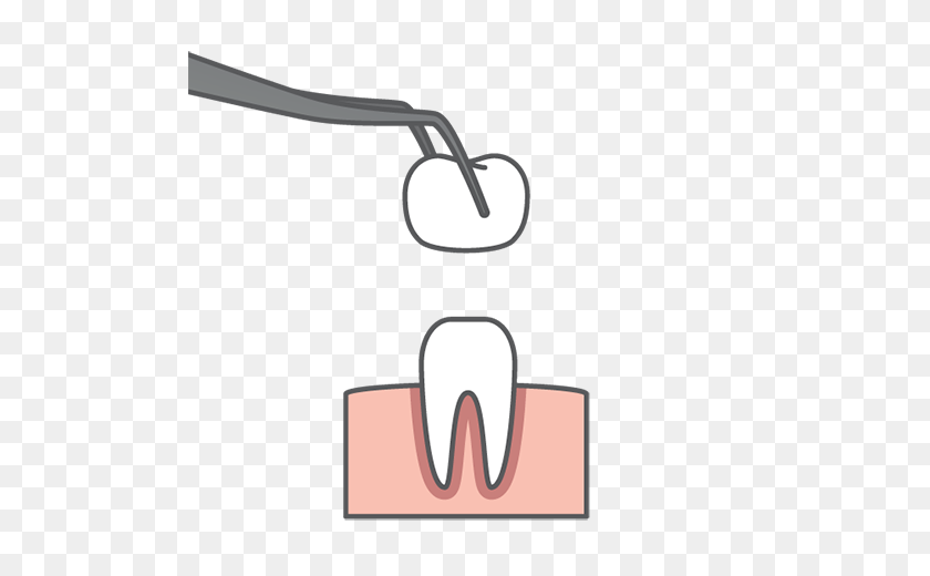 500x460 Restorative Dentistry In Smithville, Mo - Dentures Clipart