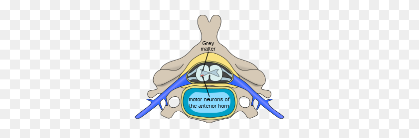 300x218 Spinal Muscular Atrophy - Spinal Cord Clipart
