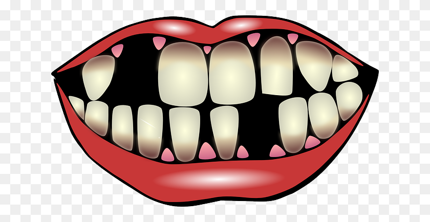 640x374 Клипарт Зубы Губы, Изучите Рисунки - Открытый Рот Клипарт