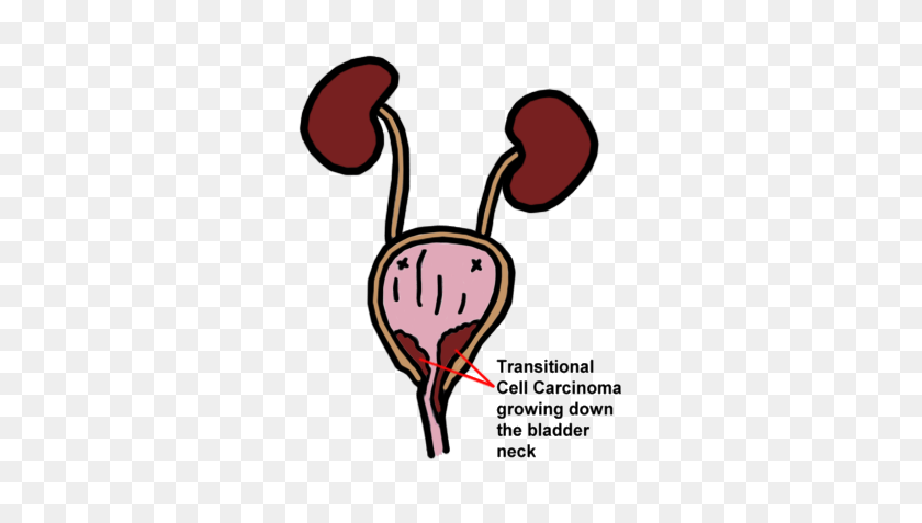 297x417 Transitional Cell Carcinoma - Dog Peeing Clipart