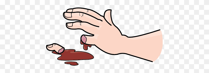 Wound Clipart Bleeding Kansas - Bloody Hand Clipart.