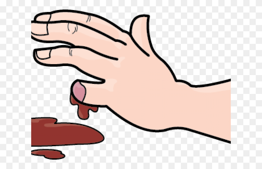 640x480 Wound Clipart Realistic - Bloody Hand Clipart