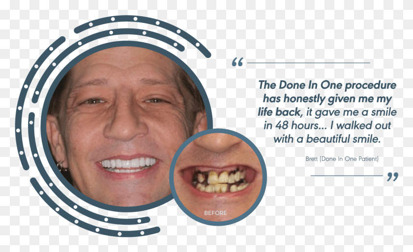 1275x743 0 Testimonial Brett 3 Стоматологические Брекеты, Челюсть, Зубы, Рот Png Скачать