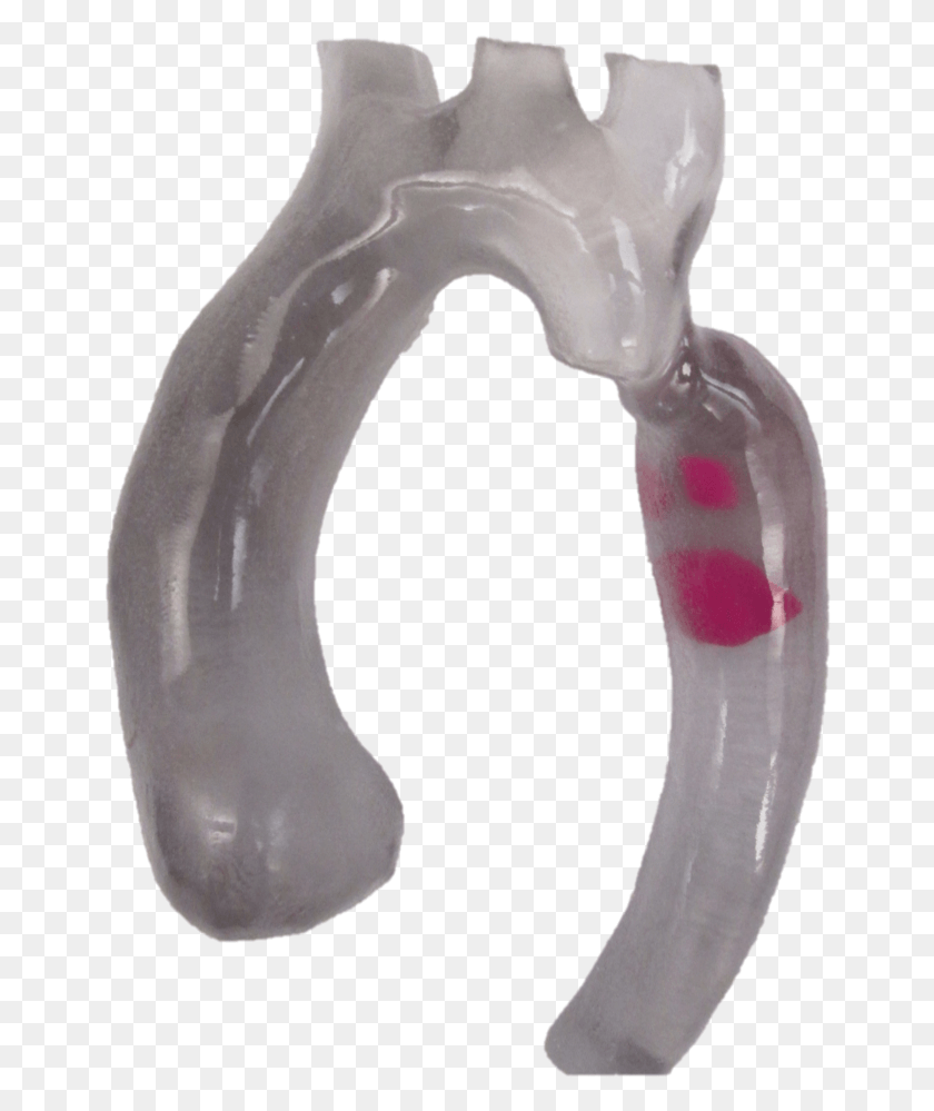 654x939 3d Printed Aortic Arch With Thrombus Diagonal Pliers, Porcelain, Pottery HD PNG Download