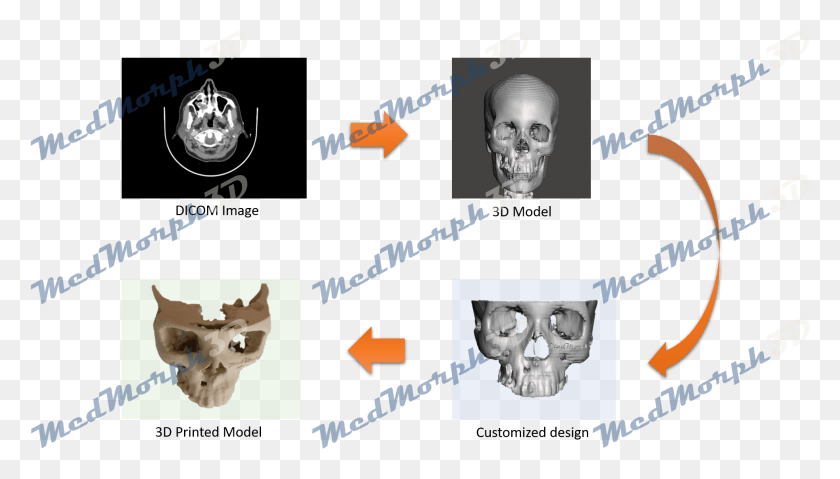 1965x1057 3d Skull Choppers, Person, Human, Face HD PNG Download