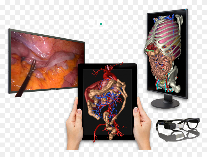 914x679 Descargar Png Tecnología 3D Aplicada A La Cirugía Diseño Gráfico, Langosta, Mariscos, Vida Marina Hd Png