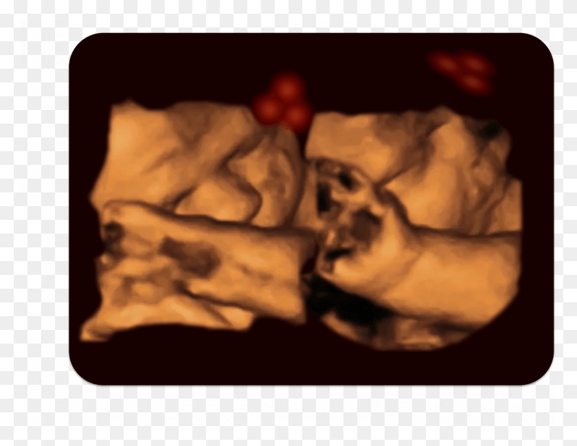 1500x1134 A 4 D Ultrasound Of A Fetus Tracking The Stimulus Fetus, Hand, Figurine, Finger HD PNG Download