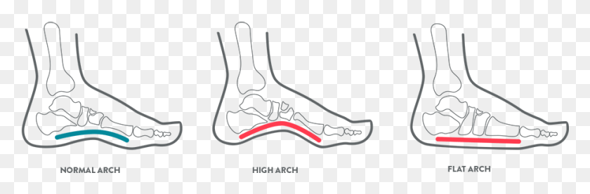 927x258 A Kids Foot Health Diagram Illustrating Arch Position Foot Diagram Kids, Outdoors, Plot, Nature HD PNG Download