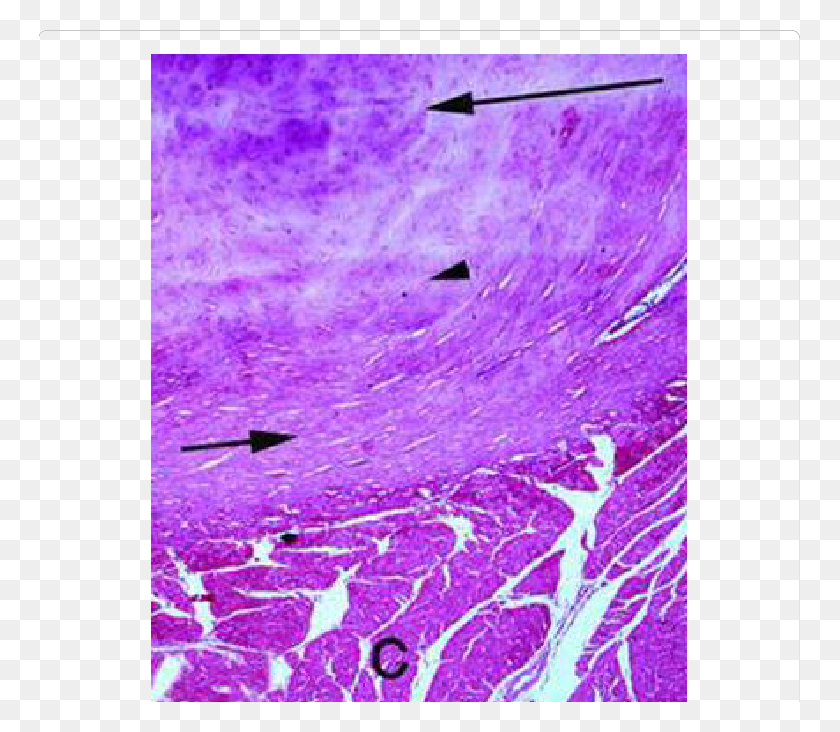 761x672 A Photomicrograph Showing The Hyaline Cartilage Fibrous Modern Art, Purple, Canvas HD PNG Download