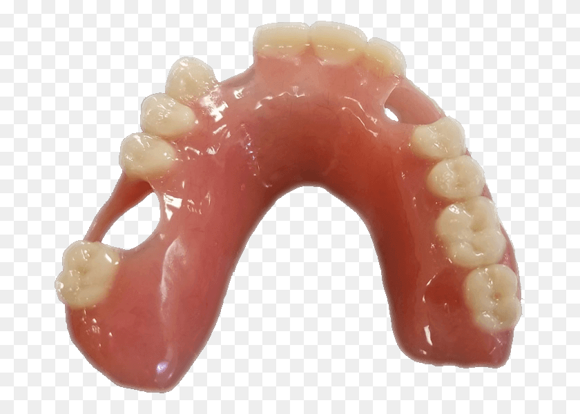 681x540 Add Tooth To Existing Acrylic Denture Acrylic Denture, Teeth, Mouth, Lip HD PNG Download