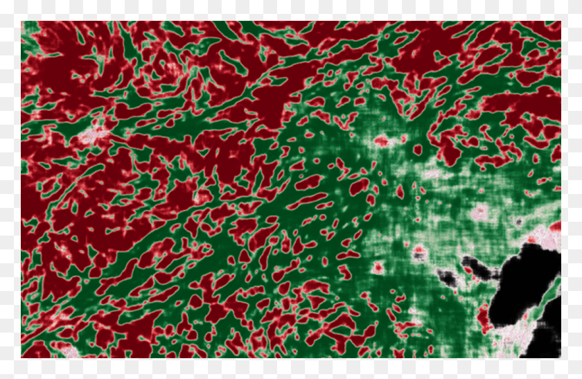 1000x625 Ai Image Overlay Of Pathology Image Искусственный Интеллект, Коврик, Узор Hd Png Скачать