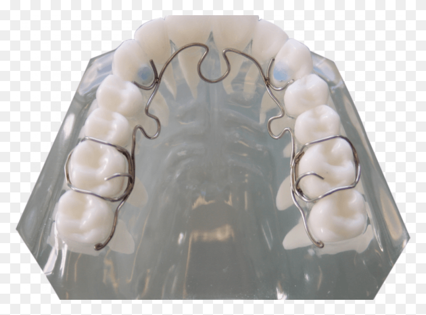 970x700 Alf Alf Appliance Tmj, Jaw, Teeth, Mouth HD PNG Download