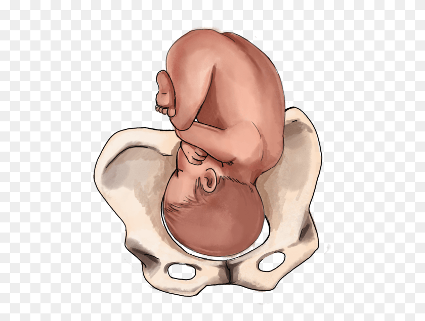 473x575 Anterior Baby Position Fetal Position Baby, Person, Human, Head HD PNG Download