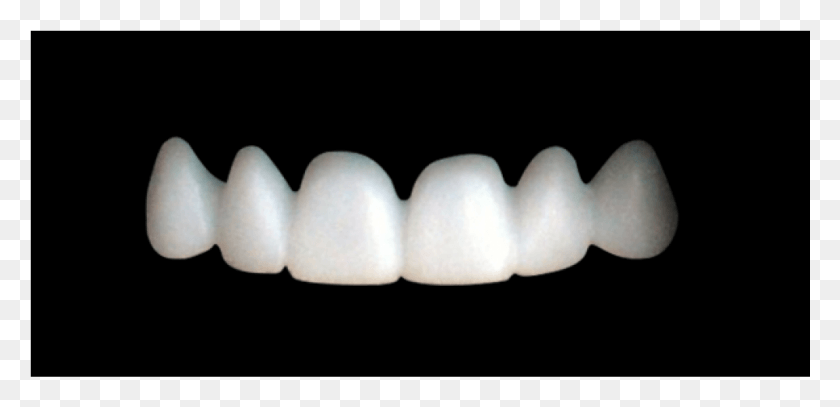 1001x446 Передний Верхний Передний Зубной Мост, Зубы, Рот, Губа Png Скачать