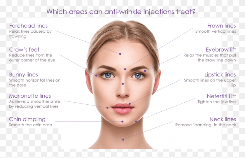 1160x718 Anti Wrinkle Injections Use Small Amounts Of Botox Skin Hyaluronic Acid, Face, Person, Human HD PNG Download