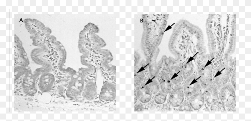 850x376 Apoptotic Changes In The Intestines Of Mice Induced Illustration, Footprint, Fossil, Bird HD PNG Download