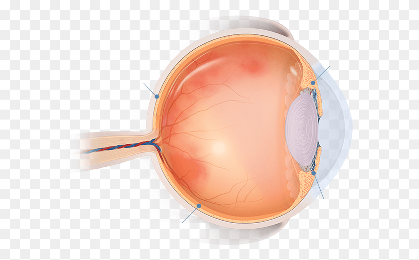 574x462 Areas Of The Eye Affected By Uveitis Circle, Sunglasses, Accessories, Accessory HD PNG Download