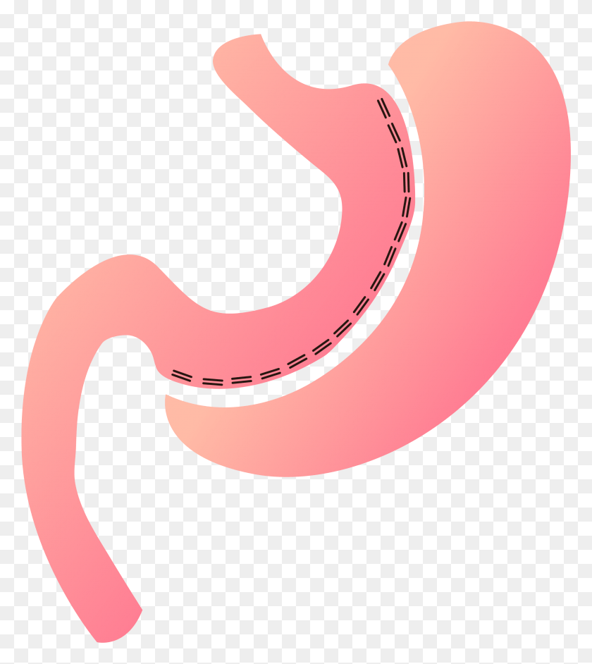 3045x3447 Artboard 46300x Gastric Sleeve, Stomach, Hammer, Tool HD PNG Download