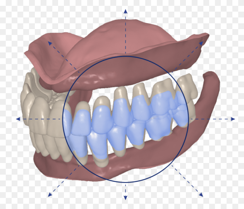 874x738 Avadent Signature Digital Dentures Dental Solutions, Teeth, Mouth, Lip HD PNG Download