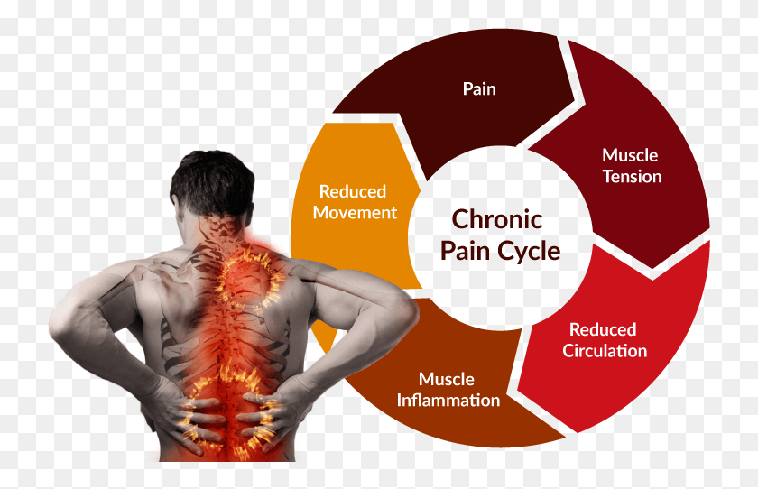 735x482 Back Pain Cycle Bigger Continuous Improvement Service Management, Person, Human, Skin HD PNG Download