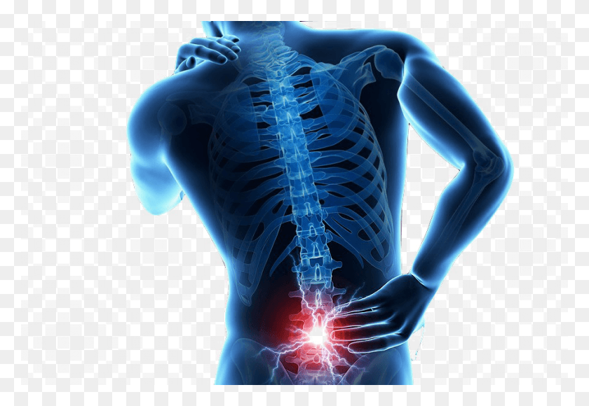 900x600 Back Pain Transparent Lesion De Espalda Baja, X-ray, Medical Imaging X-ray Film, Ct Scan HD PNG Download
