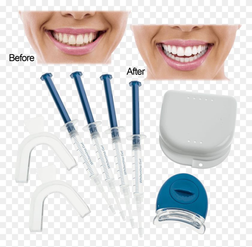 1084x1061 Bande Blanchissante Beautiful Care, Person, Human, Teeth HD PNG Download